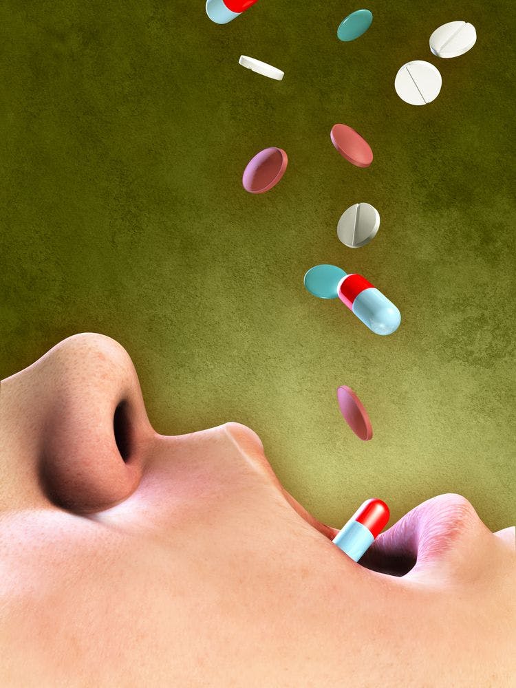 Migraine Treatment: Medication Overuse Headache 