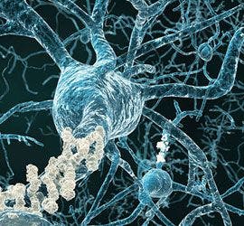 Epigenetics and Alzheimer Risk