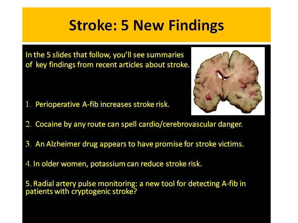 Stroke: 5 New Findings