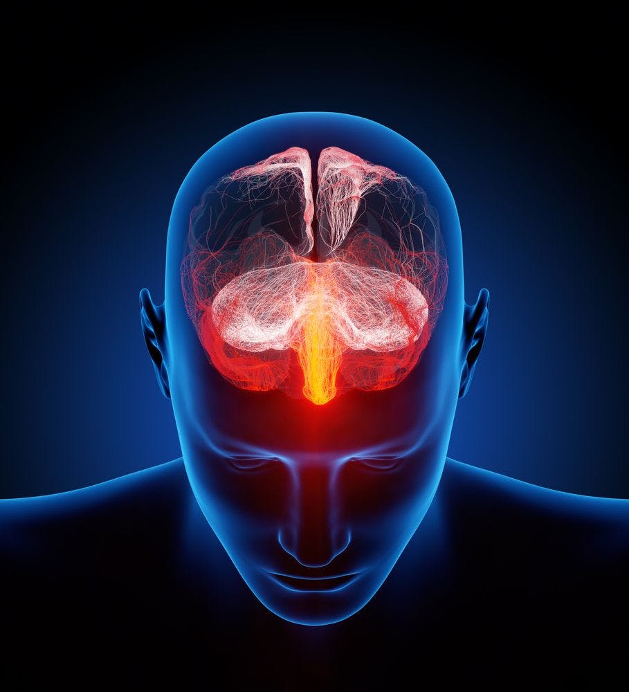 CGRP-Targeting Erenumab for Chronic Migraine